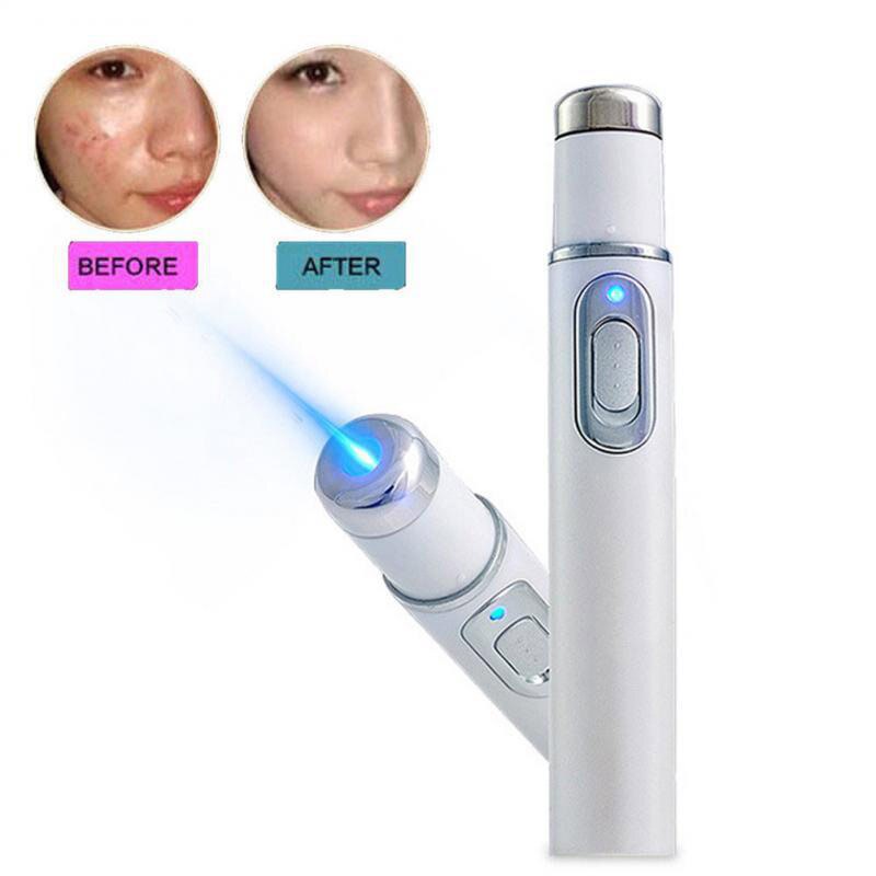 Laser Wrinkle Remover